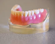 tit&aacute;n implant&aacute;tum